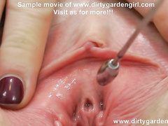 Dirtygardengirl three diffrent size peehole injections