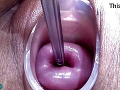 Chinese Extraordinary Cervix Shagging