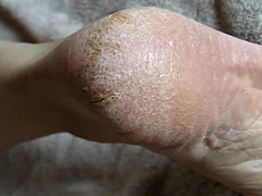 Pieds