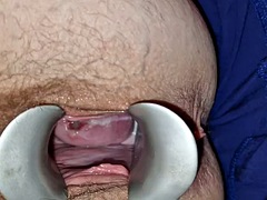 婦人科, 毛深い, マッサージ, 淫乱熟女, おもちゃ, スカートのぞき, バイブレーター, 妻