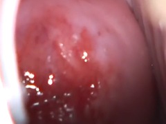 Doigter, Béant, Gyneco, Hard, Masturbation, Huilée, Rasée, Adolescente