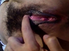 Enthousiasteling, Vingeren, Harig